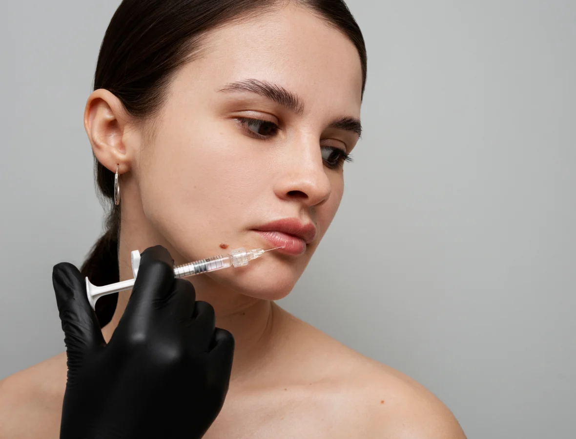 Client receiving lip filler injection for enhanced volume and symmetry at Two Chicks Aesthetics in Port Jefferson NY