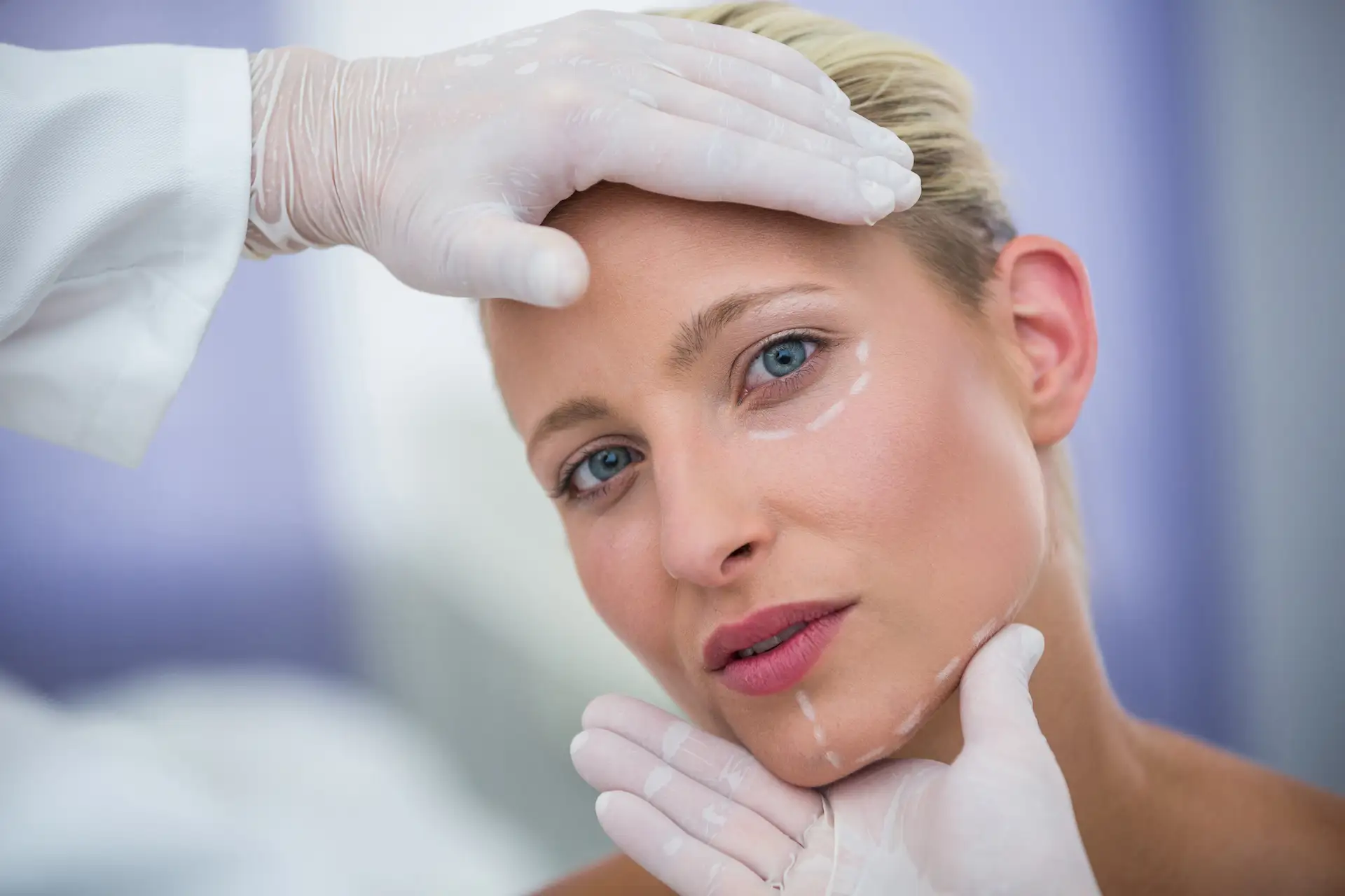 A medical professional in white gloves examines a woman’s face, marked with white guide lines for targeted Botox treatment areas around the eyes and jawline.